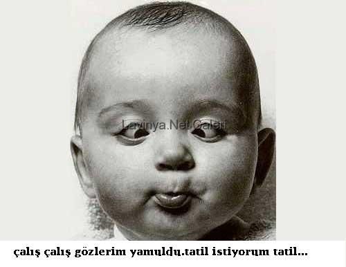 şaşı çocuk